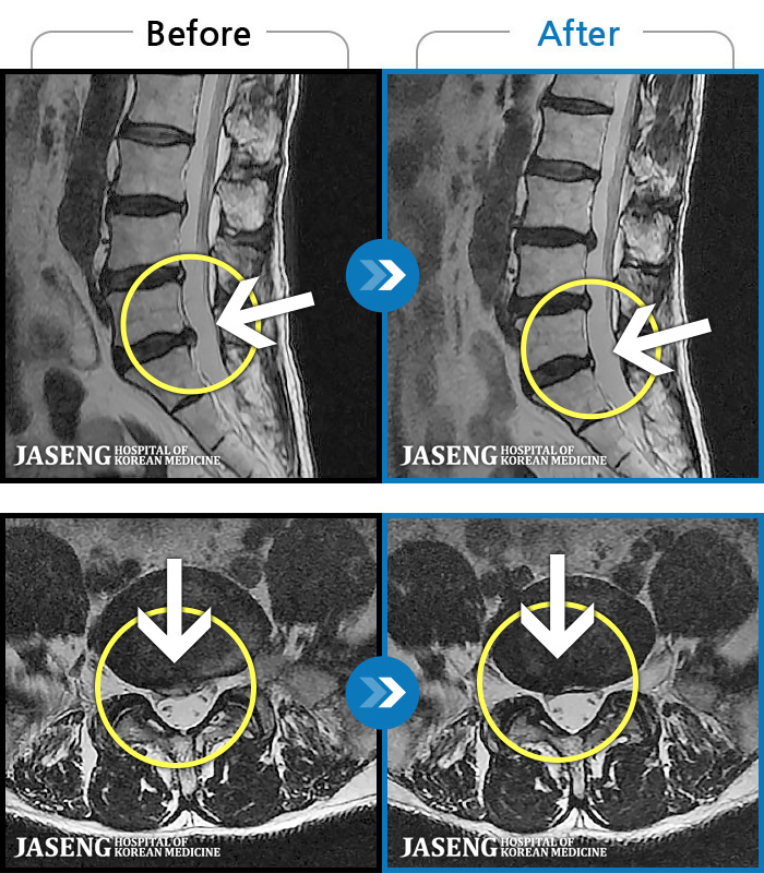 ڻǿ ġ MRI  ġ-   ϰ     ӵǾϴ. ߰ Ͽ ߰   Ǵ  ߵ ̻  ȣϴ ¿ϴ.