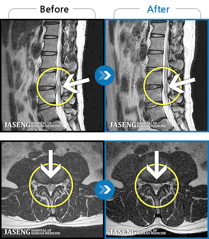 ������ڻ��ѹ溴�� ġ���� MRI�� ���� ġ����-��ġ���� ���� �ٸ����� ����, �������� ������ ���� �����. 