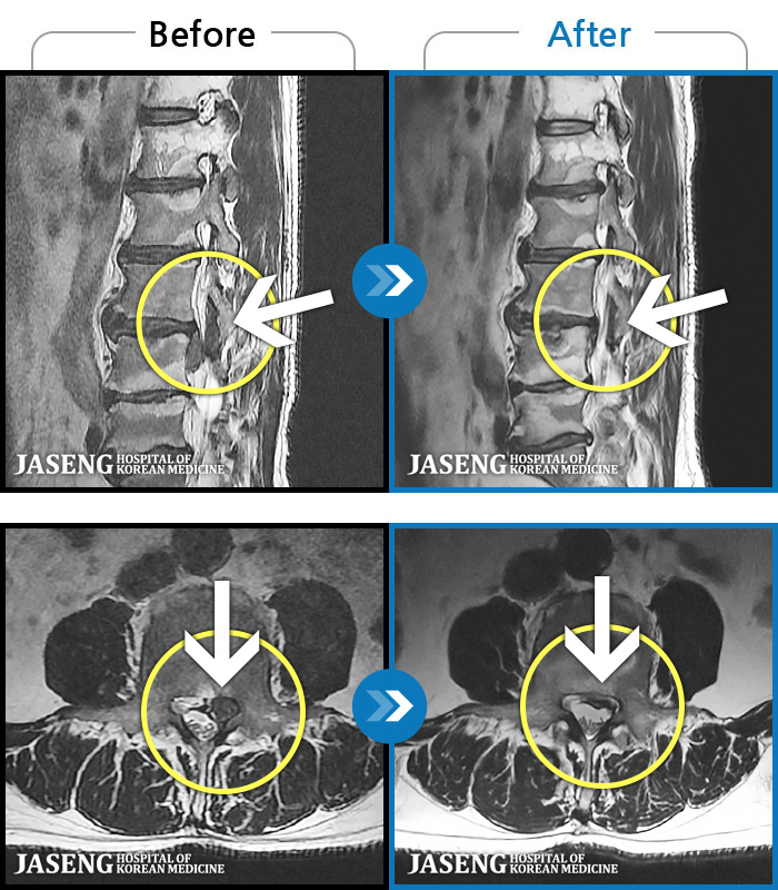 ûڻѹ溴 ġ MRI ġ-㸮 Ͽ ϻȰ ¿ϴ.