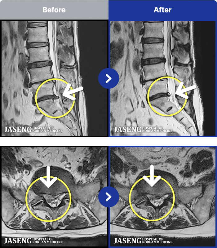 �����ڻ����ǿ� ġ���� MRI�� ���� ġ����-���� �߹ٴ��� ������ ������ �ִ� ���·� �����ϼ̽��ϴ�.