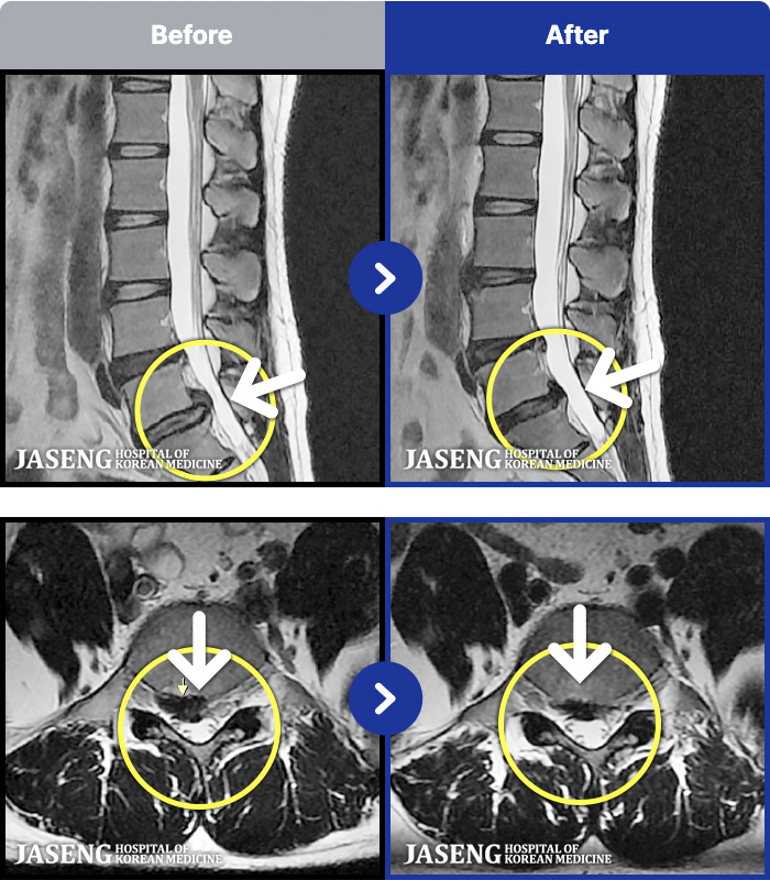 �����ڻ����ǿ� ġ���� MRI�� ���� ġ����-�㸮 ���� ��� ����