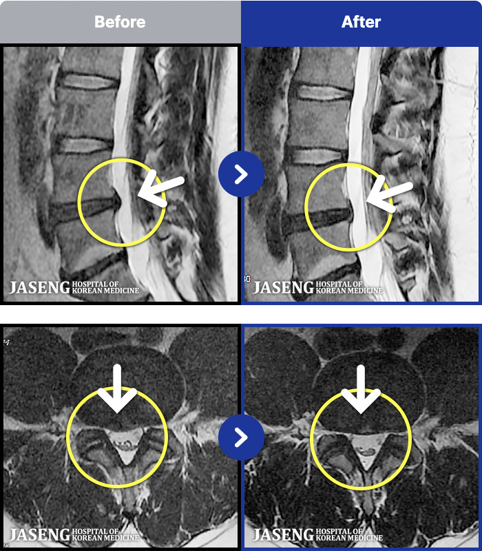 �����ڻ����ǿ� ġ���� MRI�� ���� ġ����-�������� ��� �㸮���� ��ħ�� �Ͼ�� �� ������ ���ؿ�.