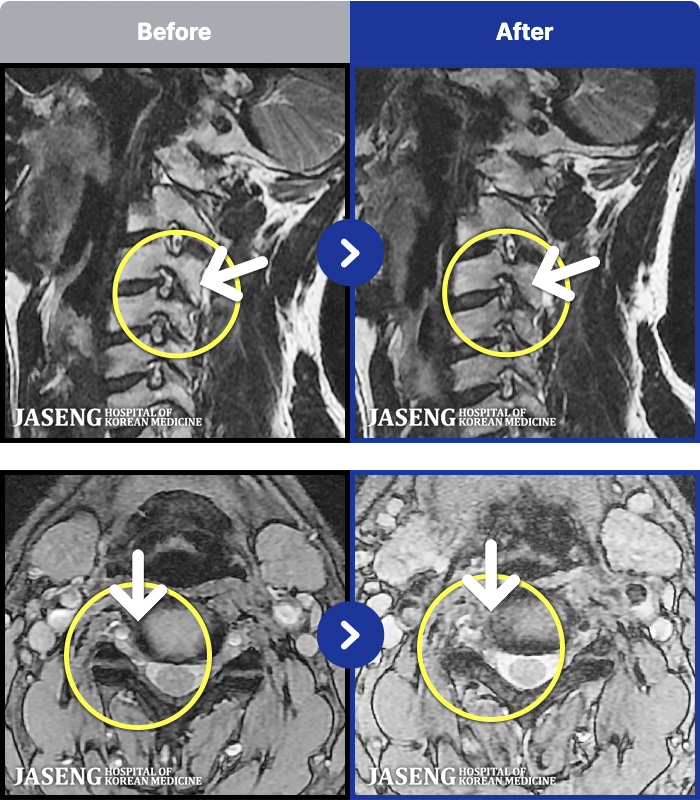 �����ڻ����ǿ� ġ���� MRI�� ���� ġ����-�ð��� ������ �������� �ʴ� �������� ����