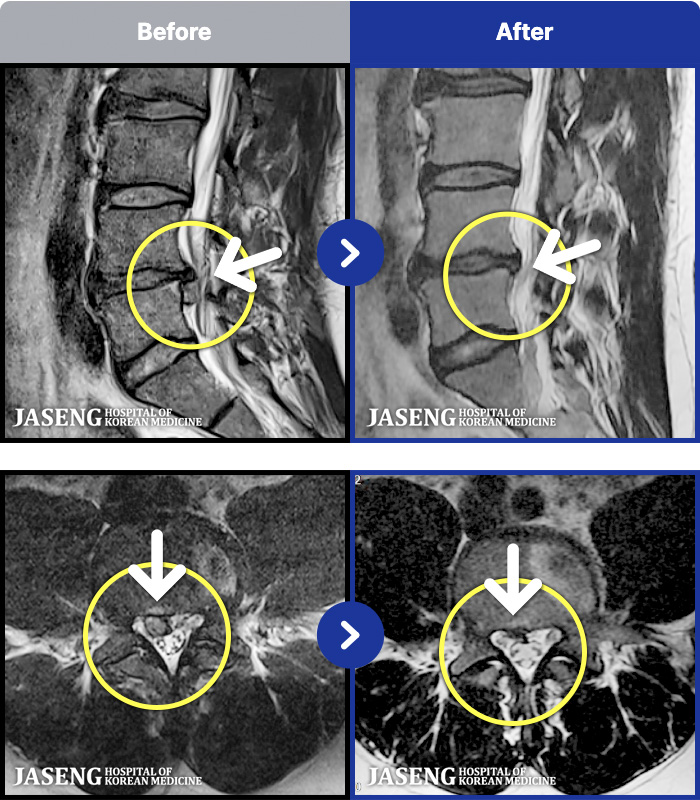 �����ڻ����ǿ� ġ���� MRI�� ���� ġ����-��������� ���ϰ� �߱��� ���� 10���̻� ���� �� ����.