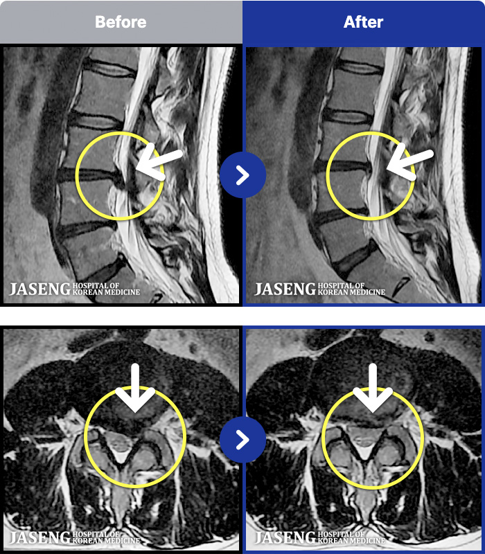 �����ڻ����ǿ� ġ���� MRI�� ���� ġ����-���� ���Ƹ��� ������ ���� �� �� �����.