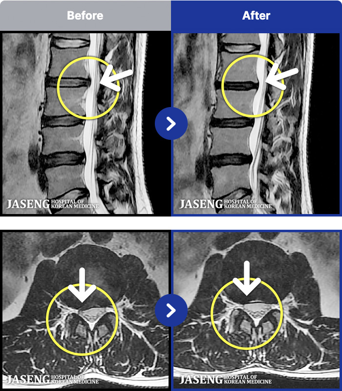 �����ڻ����ǿ� ġ���� MRI�� ���� ġ����-�㸮�������� �ŵ��� �ȵȴ�.