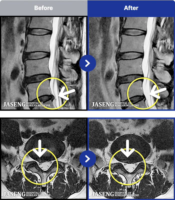 �����ڻ����ǿ� ġ���� MRI�� ���� ġ����-������ ��ݺ��� ��������� �������� ���� ����