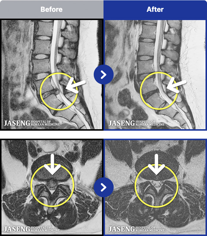 õڻѹ溴 ġ MRI ġ- ȣϿ ũ