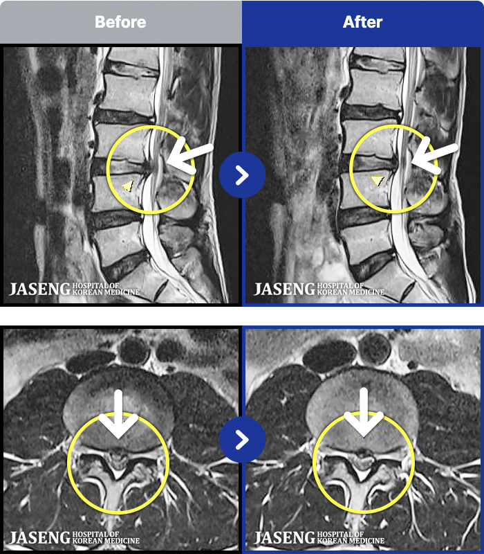 �����ڻ����ǿ� ġ���� MRI�� ���� ġ����-�㸮���� ��� ����,  ���� �� ���� �ٸ� ������ ���� ��ȭ�Ǿ� �����ϼ̽��ϴ�.