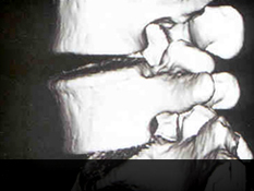 목동자생한방병원 허리질환 퇴행성디스크-정상척추에 관련된 이미지 입니다.