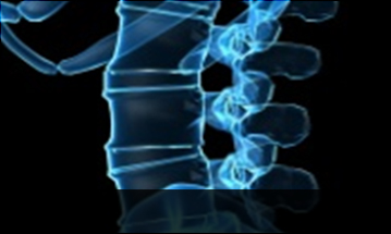 목동자생한방병원 허리질환 척추전방전위증-정상적인 사람의 척추뼈 모습입니다.