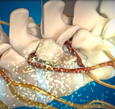 목동자생한방병원 허리치료법 신경근회복술-신경근회복술의 특징 네번째 관련 사진 입니다.